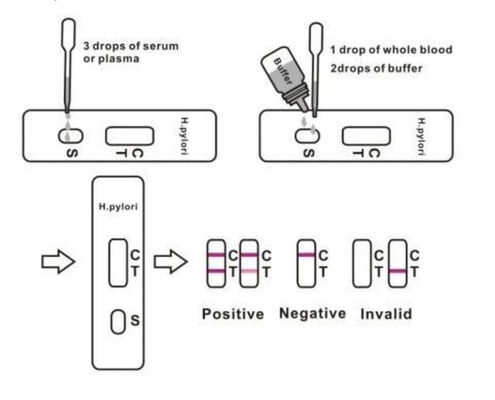 ชุดตรวจหาแอนติบอดีอย่างรวดเร็ว H Pylori Stool Test Kit Cassette